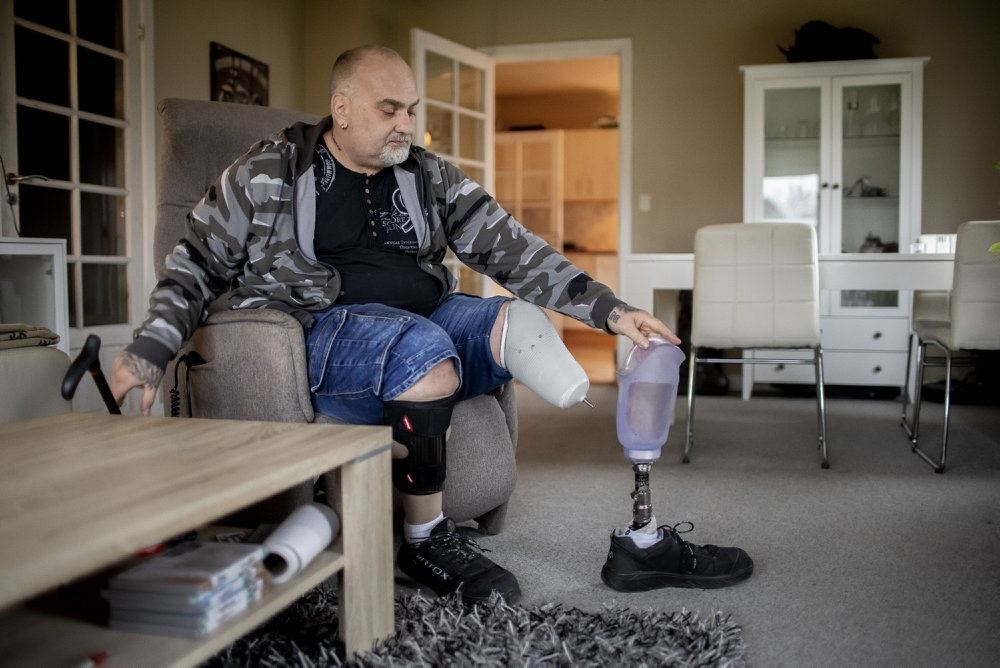mand med benprotese sidder på stol i stue