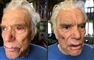 to billeder af en forslået Bernard Tapie