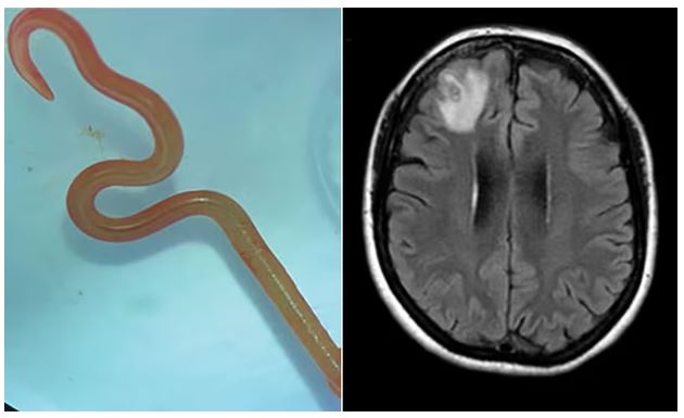 en orm og et røntgenfoto af en hjerne